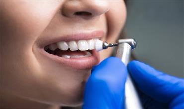 چه موقع به جرم گیری دندان نیاز داریم؟ 